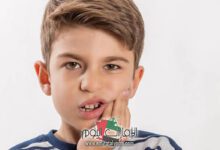 تخفيف آلام الأسنان