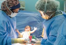 تعرفي على الولادة القيصرية ومميزاتها وعيوبها 4 الولادة القيصرية ومميزاتها وعيوبها