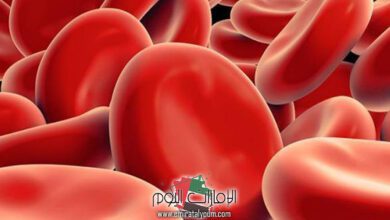 ارتفاع الصفائح الدموية 600