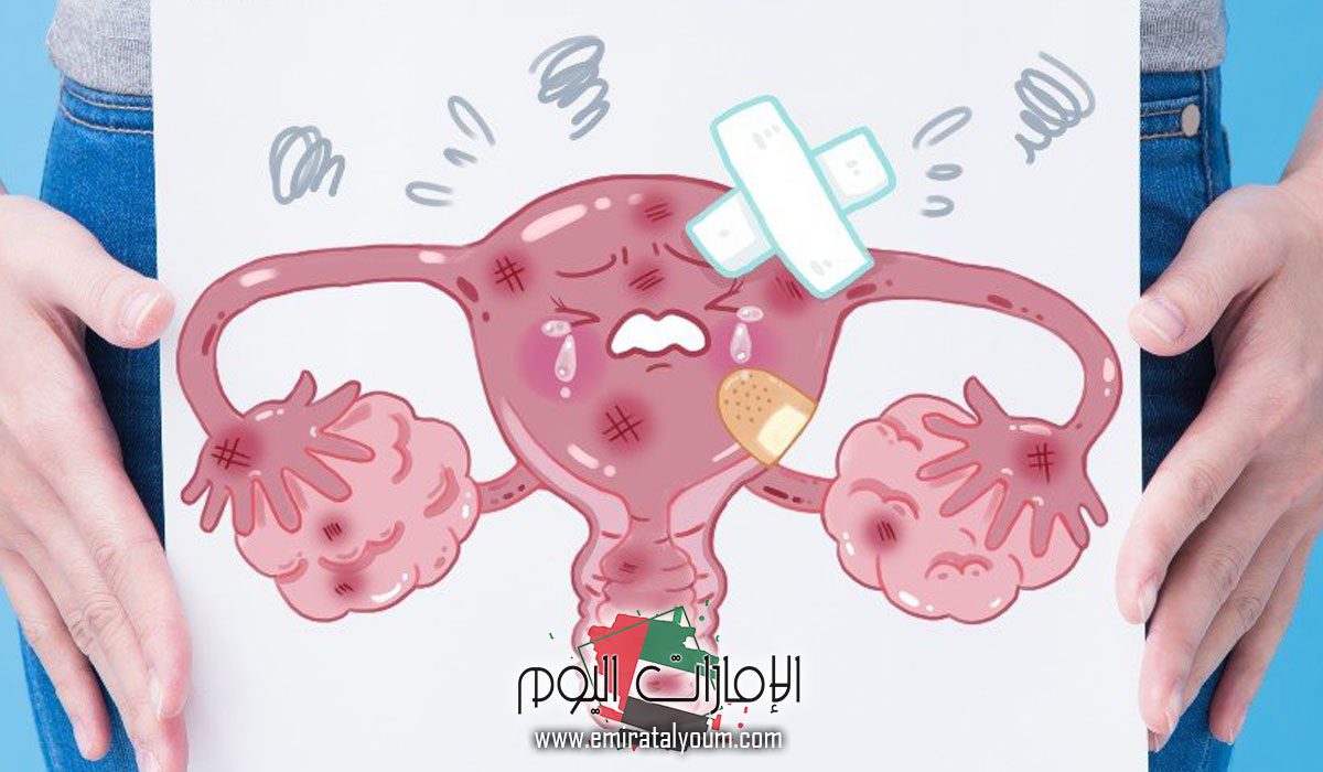 علامات الرحم النظيف بعد الاجهاض