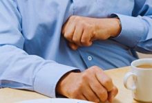 esophageal candidiasis