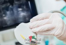 شكل البويضات في السونار