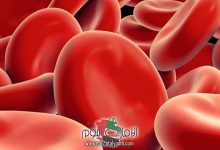 ارتفاع الصفائح الدموية 600 4 ارتفاع الصفائح الدموية 600