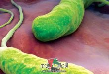 اكلات تقتل جرثومة المعدة | علاج جرثومة المعدة نهائيا 4 متى تموت جرثومة المعدة