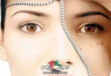 النشا والخل لتفتيح الوجه