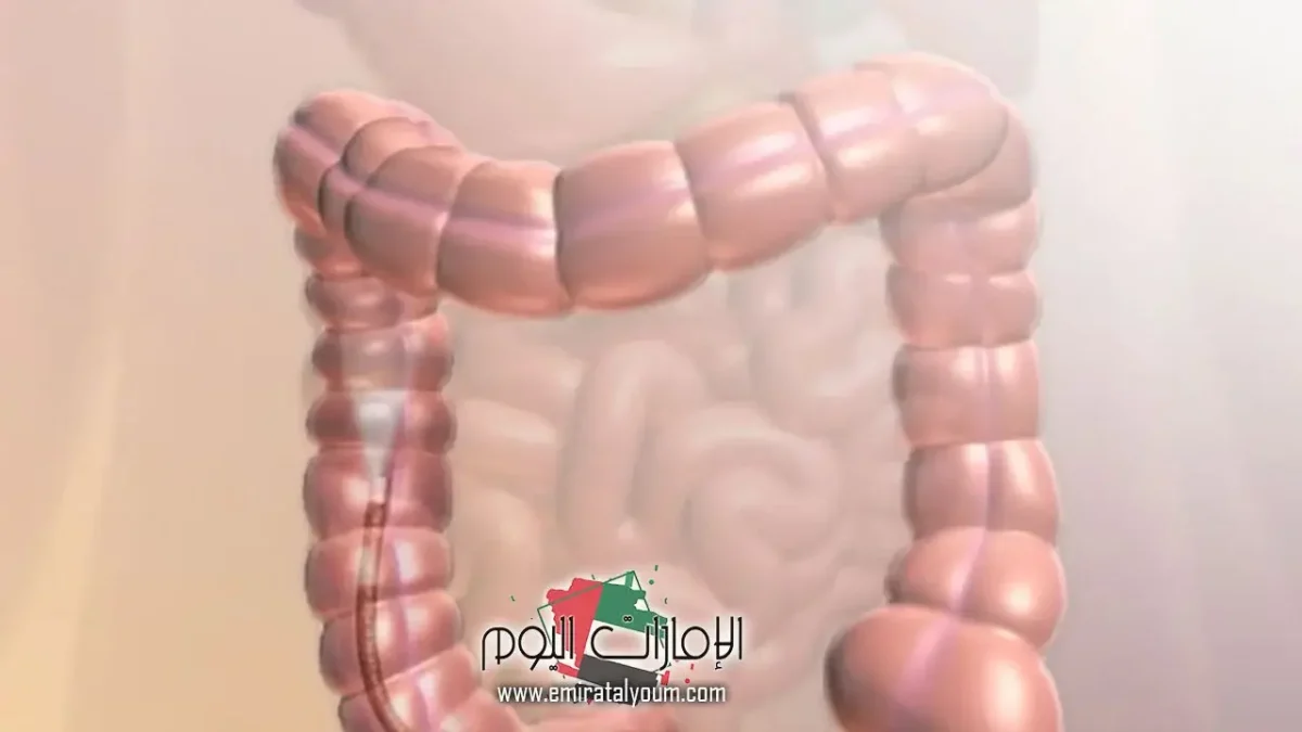 أعراض القولون العصبي وأسبابه وطرق للعلاج 1 أعراض القولون العصبي