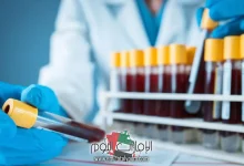 علاج ارتفاع الفوسفور بالاعشاب 4 ارتفاع الفوسفور