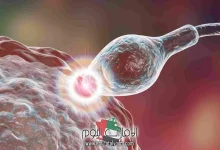 البويضه انفجرت وتلقحت